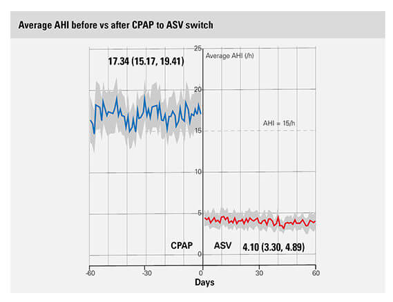 big-data-ASV-byta-AHI-ResMed