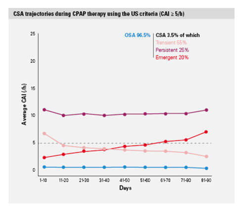 big-data-CSA-utveckling-USA-villkor-ResMed